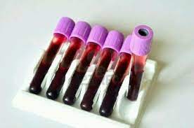 Adrebs Medical Labouratory And Blood Bank.